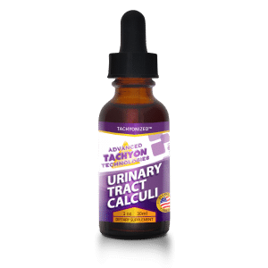 Tachyonized Urinary Tract Calculi Remedy